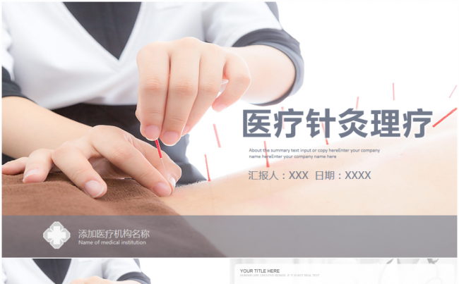 【FG演示】医学医疗医院医生护士节中医针灸2017工作计划缩略图