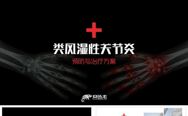 【狂人作品】类风湿性关节炎疾病治疗与预防方案PPT缩略图