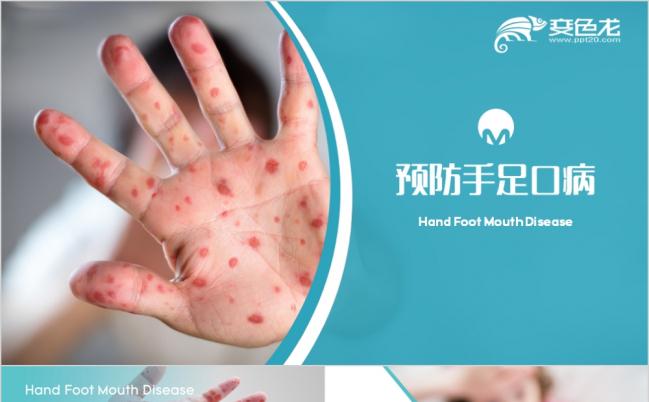 传染疾病的预防与治疗PPT模版缩略图